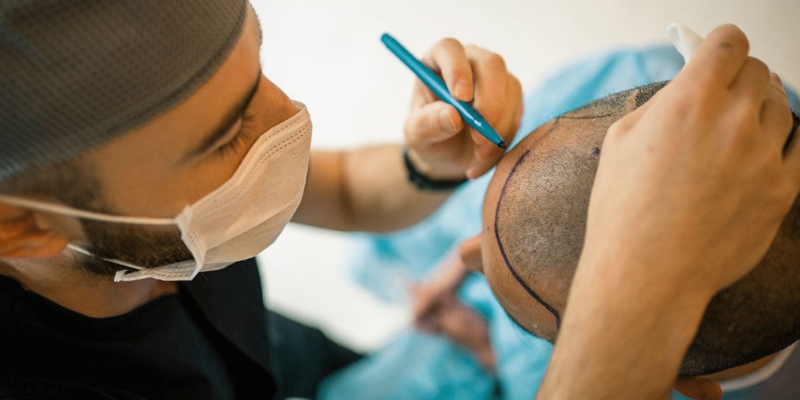 Hair Transplant Clinic in Vizag